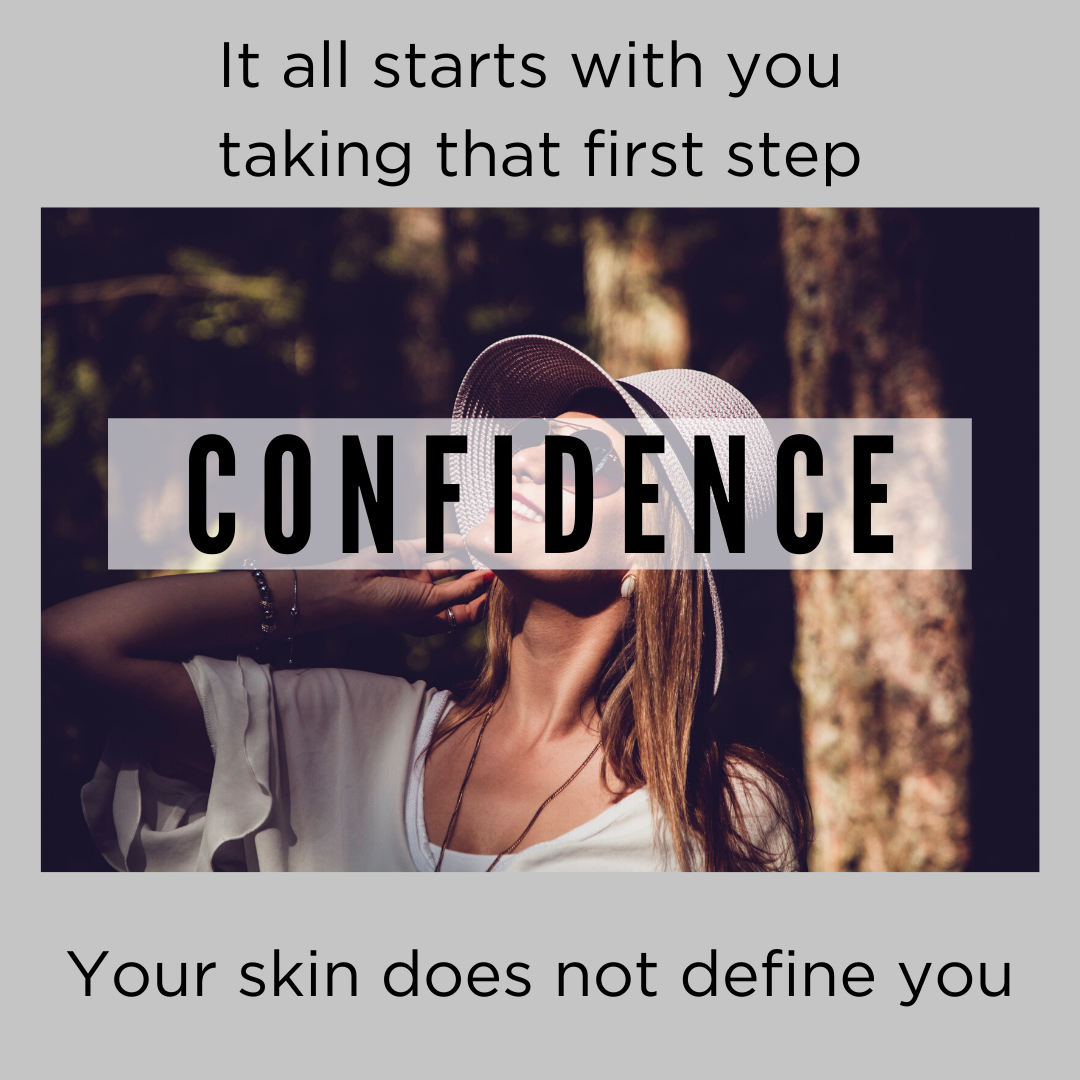 Featured image for Boosting Your Confidence While Battling Acne? Practical Advice.