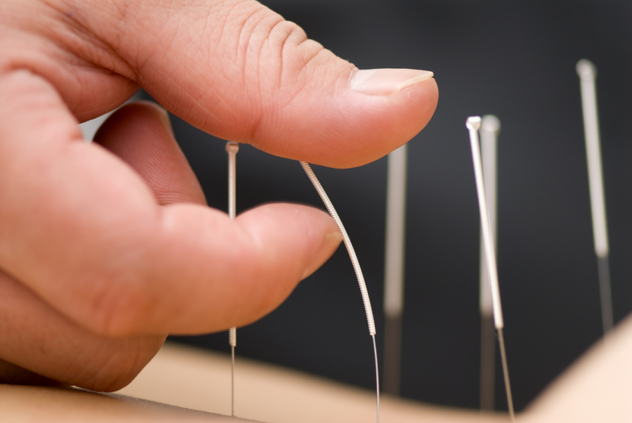 Featured image for Fear of Needles Preventing Your Acupuncture Treatment? Understanding the Process.