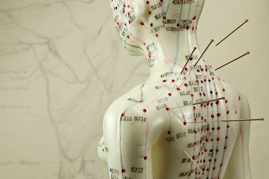 Content image for Unsure if Acupuncture Works for Your Chronic Pain? Exploring Its Effectiveness.