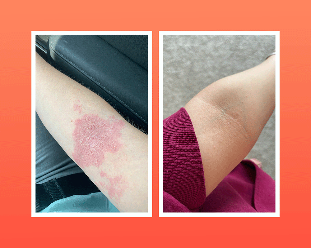 Featured image for The Link Between Gut Health and Clear, Glowing Skin