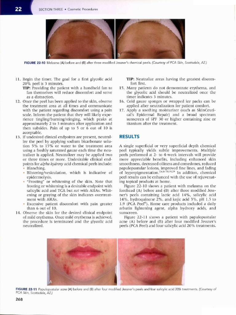 Featured image for Recovery Expectations After Common Cosmetic Procedures