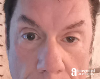 Content image for Common Misconceptions About Surgical Aesthetic Enhancements