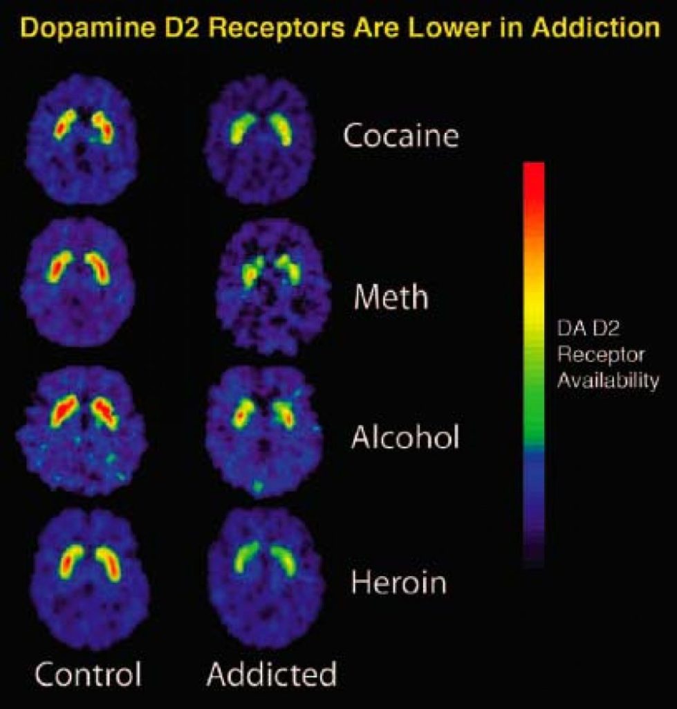 Content image for How Drug Abuse Alters Brain Chemistry and Behavior Over Time