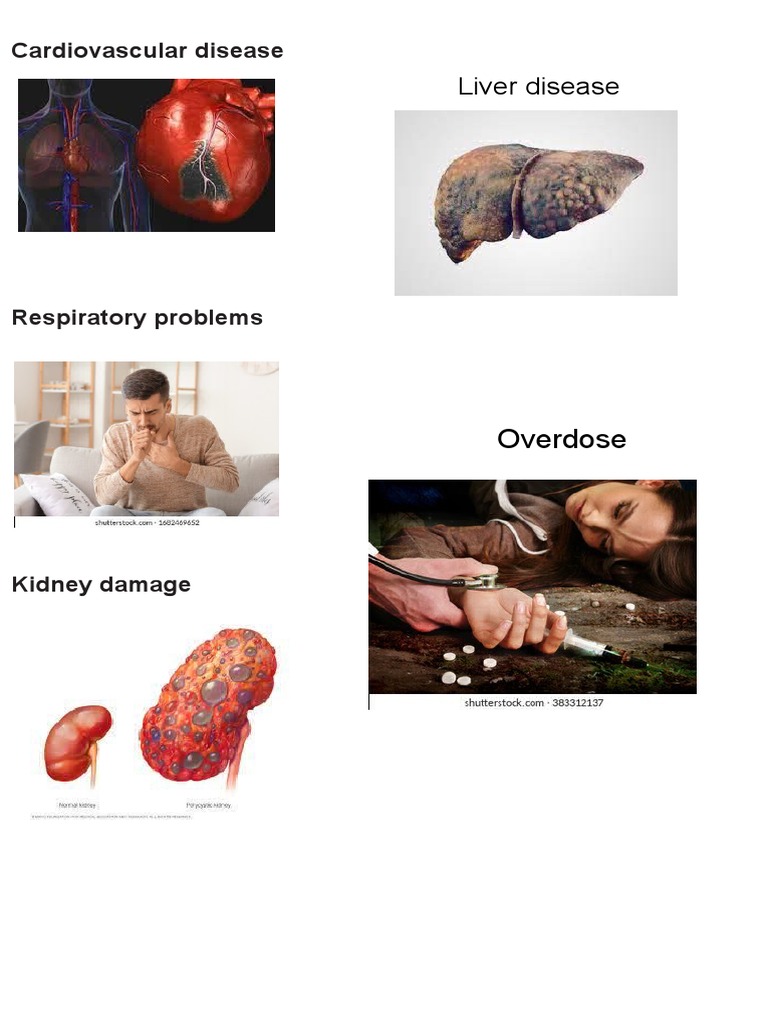Featured image for The Impact of Drug Abuse on Physical Health and Organ Function