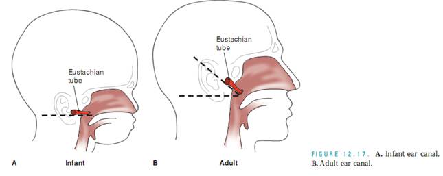 Featured image for The Impact of Ear Infections on Long-Term Auditory Function