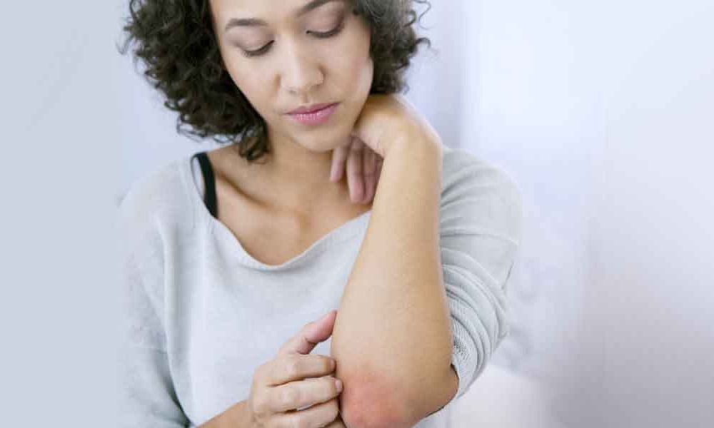 Content image for How Environmental Triggers Worsen Eczema Flare-Ups Unexpectedly