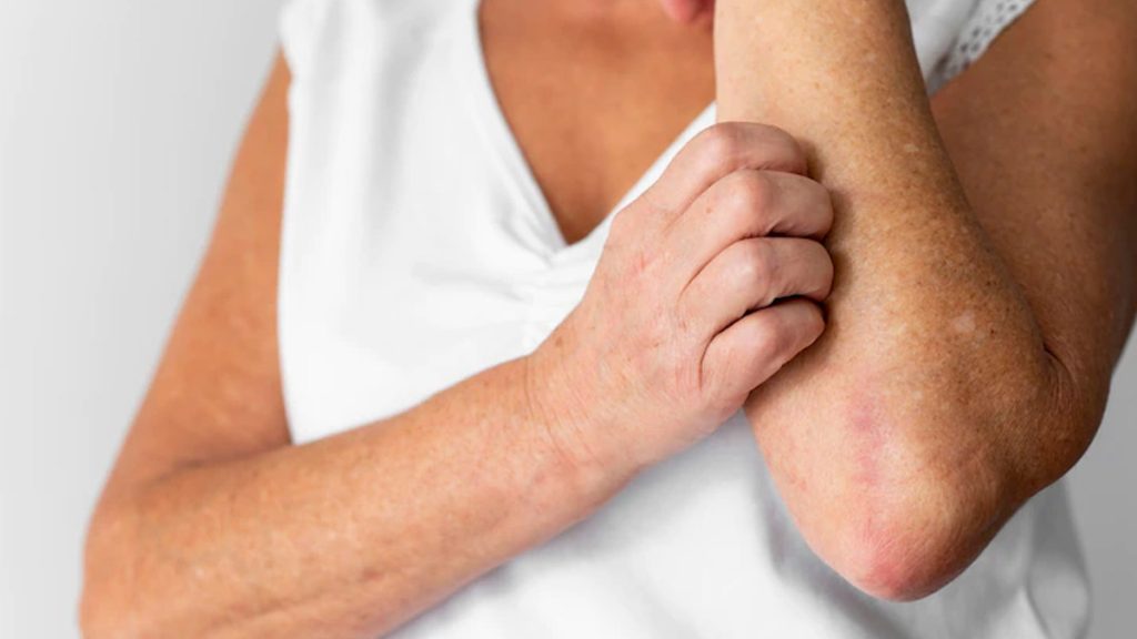 Content image for The Connection Between Stress and Increased Skin Inflammation