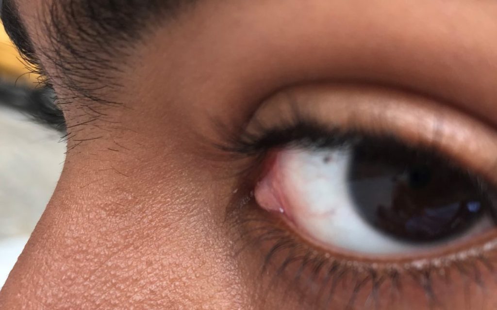 Content image for Natural Ways to Maintain Sharp Vision as You Age Gracefully