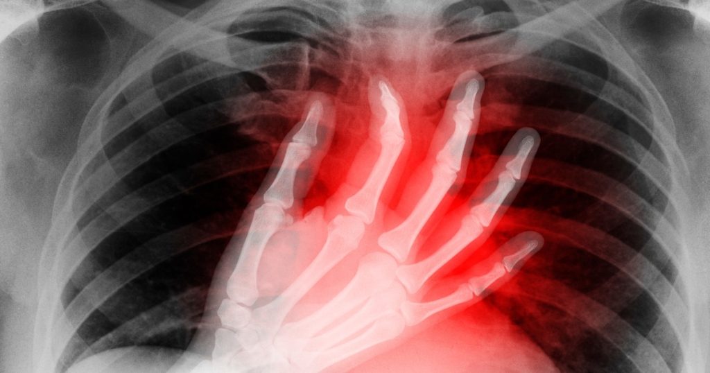 Content image for Impact of Stress on Heart Function and Recovery