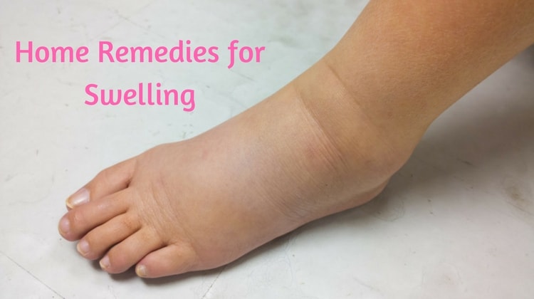 Featured image for Effective Remedies Alleviating Swelling and Discomfort