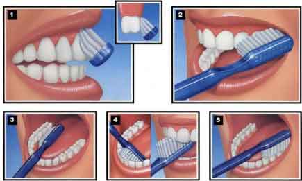 Content image for Innovative Tools Enhancing Brushing and Flossing Techniques