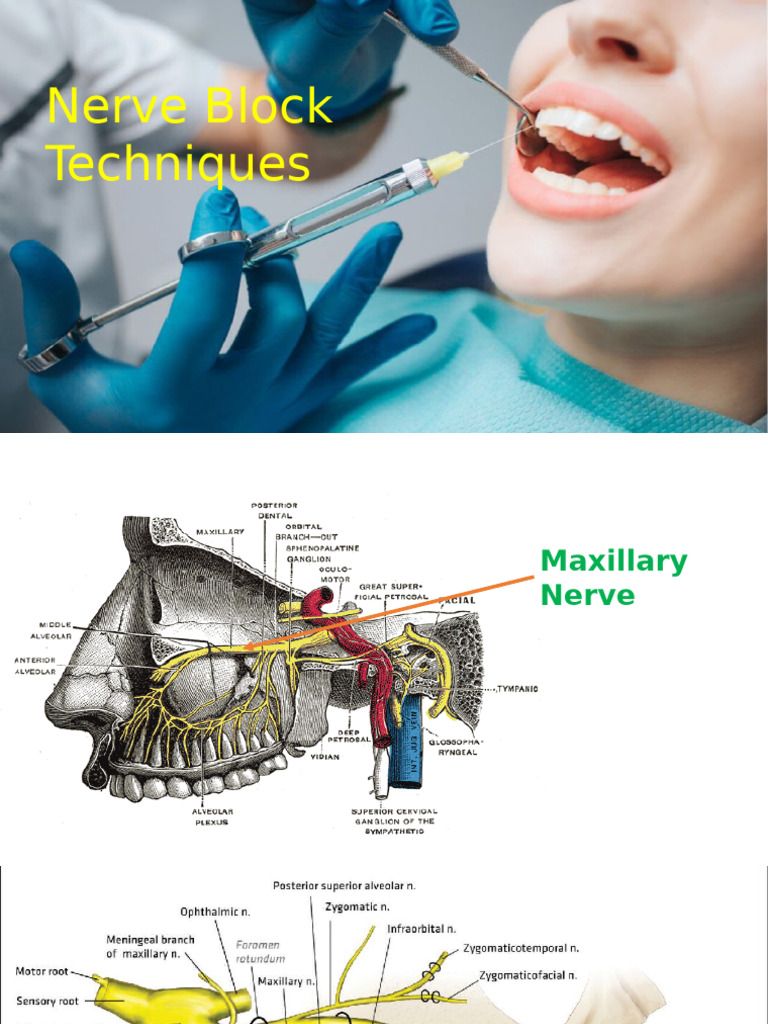 Featured image for Innovations in Targeted Nerve Block Treatments
