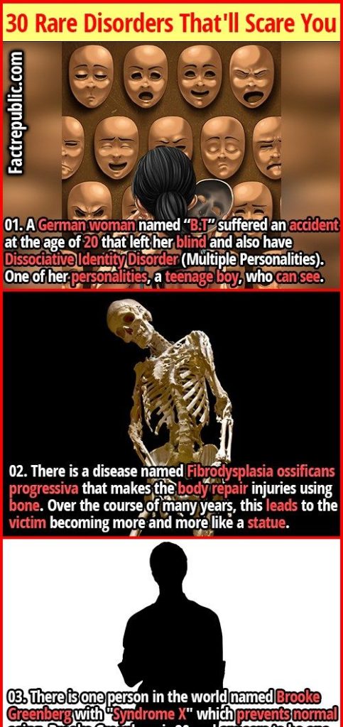 Content image for Understanding Symptoms Linked to Rare Medical Disorders